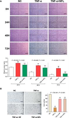 Corrigendum: Nanofat lysate ameliorates pain and cartilage degradation of osteoarthritis through activation of TGF-β-Smad2/3 signaling of chondrocytes
